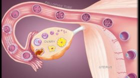 علاج ضعف الخصوبة الناجم عن انقطاع التبويض