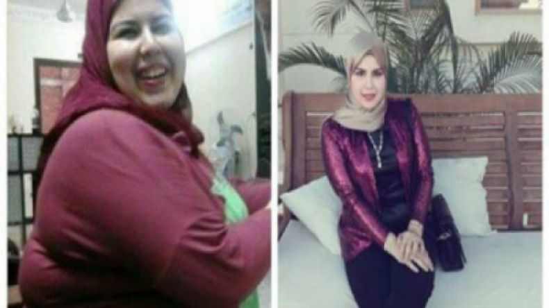 مصرية تتخلص من نصف وزنها تجنبا للمضايقات