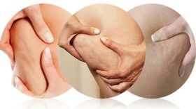 هل يمكن التخلص من السيلوليت باتباع نظام غذائي؟!