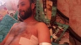 منتخب يعتدي بالضرب على مريض بالسرطان بمستشفى خنشلة