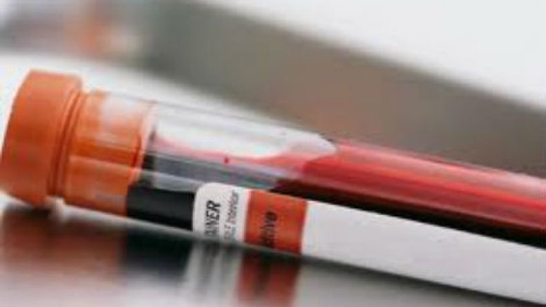 علماء يحللون قلب ريتشارد قلب الأسد لمعرفة أسباب وفاته