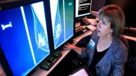 عقد الثدي.. أهي دليل على الإصابة بالسرطان؟