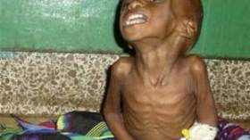 تركيا تنادي باجتماع عاجل لمنظمة المؤتمر الاسلامي لبحث المجاعة في الصومال