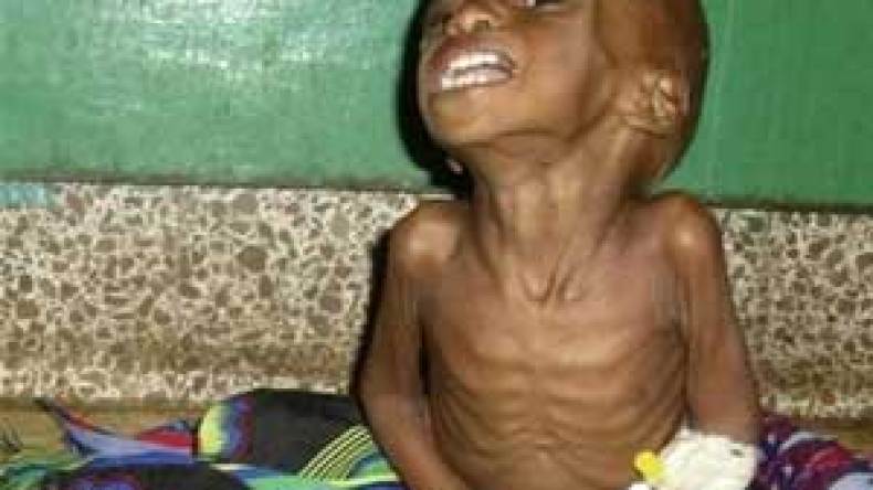 تركيا تنادي باجتماع عاجل لمنظمة المؤتمر الاسلامي لبحث المجاعة في الصومال