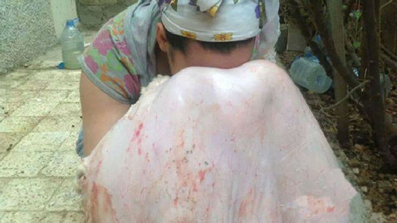 فتيات أجبرن أنفسهن على مسح وجوههن بجلد الأضحية!