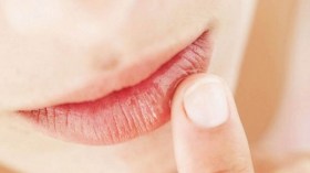 هكذا تتخلصين من تشقق الشفاه؟!