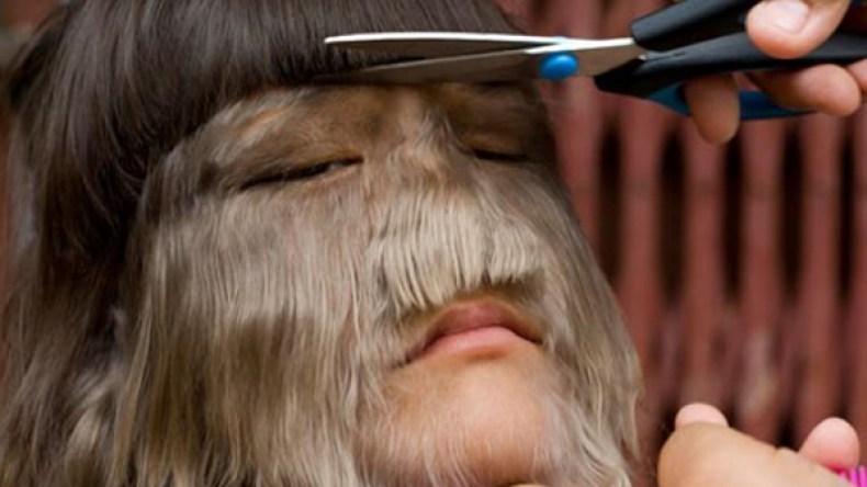 زواج أكثر فتاة “مشعّرة” في العالم