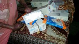 سعيدة وأمال ولدتا بمرض جلدي غريب شوه جسديهما