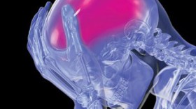 30  بالمئة من المصابين بجلطة قلبية مصيرهم الموت بالجزائر