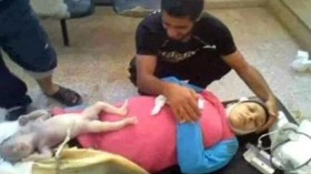 سيدة تضع مولودها “بالمصعد” بسبب انقطاع الكهرباء