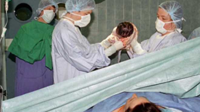 ‭ ‬ولد‭ ‬عباس‭ ‬يحذر‭ ‬الأطباء‭ ‬من‭ ‬العمليات‭ ‬القيصرية‮ ‬ويطالب‭ ‬بتقليصها‭  ‬