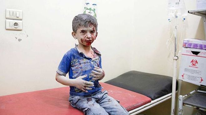 حلب تعاني من نقص الغذاء والدواء مع استمرار القصف الجوي