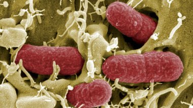 Bactérie tueuse : 30 morts déjà