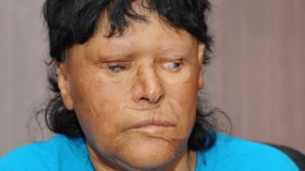 مديرية‭ ‬المجاهدين‭ ‬لولاية‭ ‬الطارف‭ ‬تحرم‭ ‬إحدى‭ ‬ضحايا‭ ‬الألغام‭ ‬من‭ ‬منحتها