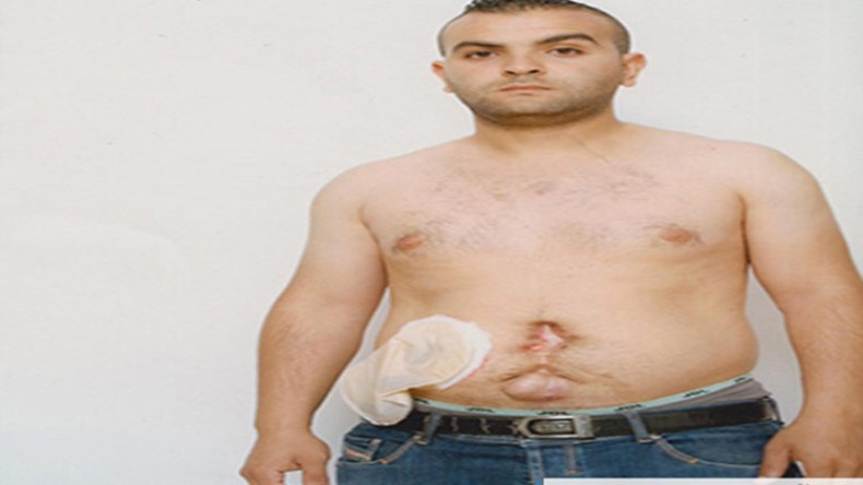 أمين: أنقذوني.. أريد أن أعيش