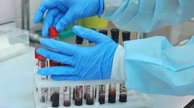 Santé: un traitement sera administré aux patients infectés