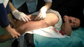 كوارث صحية في عمليات الختان والسبب أطباء غير مؤهلين