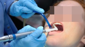 “جراحو الأسنان أول مصدر للإصابة بالكبد الفيروسي بالجزائر”