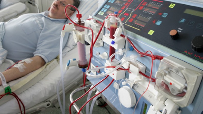 زرع الكلى أقل تكلفة 5 مرات من التصفية