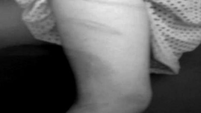 معلم ينهال على تلميذة ضربا بأنبوب بلاستيكي بقصر البخاري