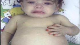 آباء وأمهات يلهثون لإنقاذ فلذات أكبادهم من الموت جوعا