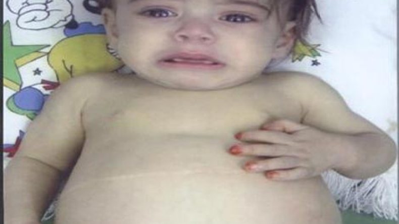 آباء وأمهات يلهثون لإنقاذ فلذات أكبادهم من الموت جوعا