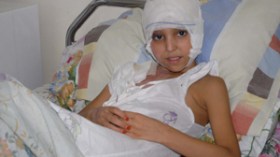 96 بالمائة من حروق الأطفال بالجزائر سببها المواقد وإهمال الأمهات