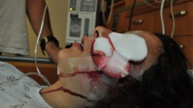 Usant de lacrymogène: des inconnus agressent la  fille d'un député  à Batna