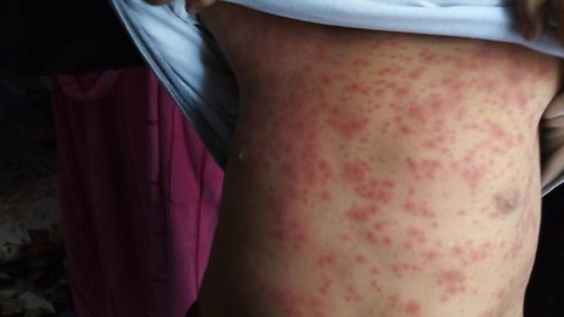 البجاويون يتحدون في حفل خيري ضخم من أجل إنقاذ الطفل فؤاد