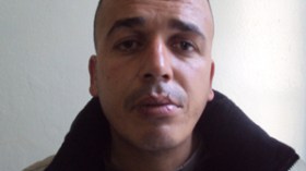 الشاب الذي أخاط شفتيه بقالمة في حالة خطيرة