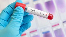 La grippe porcine “G4” n’infecte pas