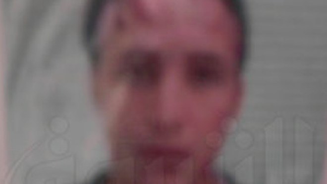 وفاة شاب من البرج بعد انتحاره حرقا بسبب أزمة السكن