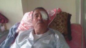 15 مريضا يفقدون البصر بعد عمليات بسيطة ولا أمل في شفائهم