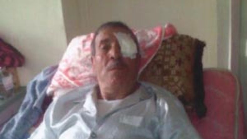 15 مريضا يفقدون البصر بعد عمليات بسيطة ولا أمل في شفائهم