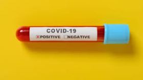 L’Algérie produira un million de tests de dépistage rapide