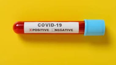 L’Algérie produira un million de tests de dépistage rapide