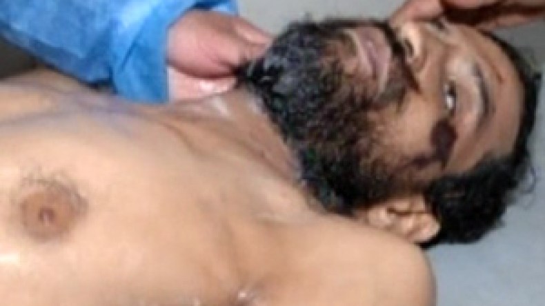 القذافي‭ ‬يسرق‭ ‬الجثث‭ ‬ويختطف‭ ‬الجرحى‭ ‬لإخفاء‭ ‬جرائمه‭ ‬