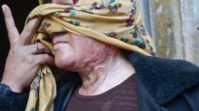 مضطهدات العالم.. تعذيب واستعباد وتنكيل بالأجساد