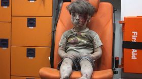 شاهد ماذا قال الأسد عن صورة الطفل عمران