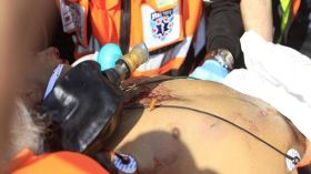 استشهاد فلسطيني متأثراً بجراح أصيب بها قبل ساعات في القدس