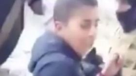 كلاب إسرائيلية تنهش طفلاً فلسطينياً