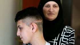 فلسطينيون مصابون بالرصاص الإسفنجي يعانون من ندوب غير قابلة للشفاء