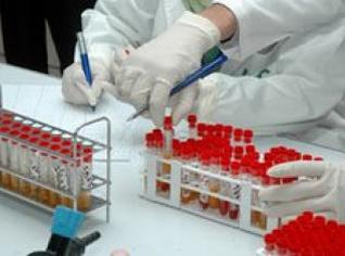 Algeria counts 29 cases of swine flu