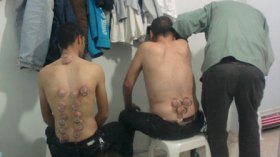 عيادات الحجامة..ثورة على الطب والأطباء