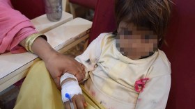 فوضى نقل الدم تصيب أطفال بالسيدا والكبد الفيروسي