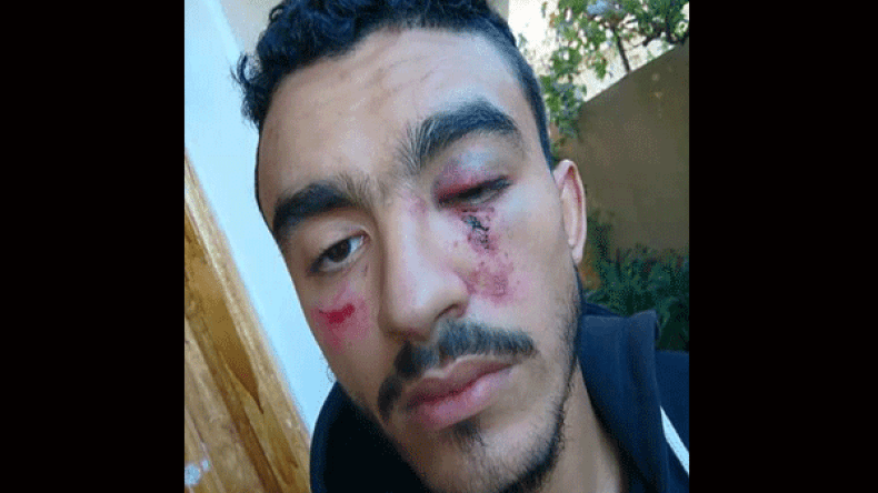 مدير ثانوية بالبليدة يعتدي على تلميذ بالضرب ويحتجزه داخل مكتب