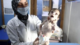 أطفال سوريون يحاصرهم النظام في غوطة دمشق يقتلهم الجوع