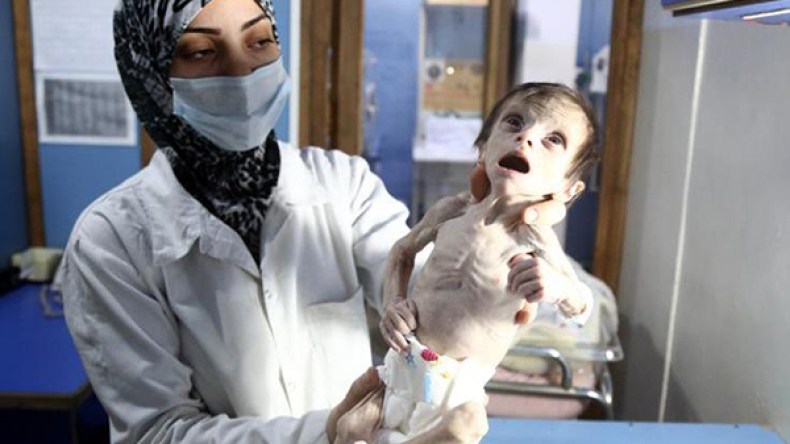 أطفال سوريون يحاصرهم النظام في غوطة دمشق يقتلهم الجوع