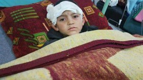 يا بابا شيلني.. صرخة طفل بترت قدماه في غارة للنظام