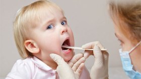 لا علاقة للوزتين بمرضى التهاب الكلى الحاد والحمى الروماتيزمية